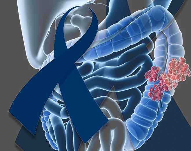 spreading-awareness-for-colorectal-cancer